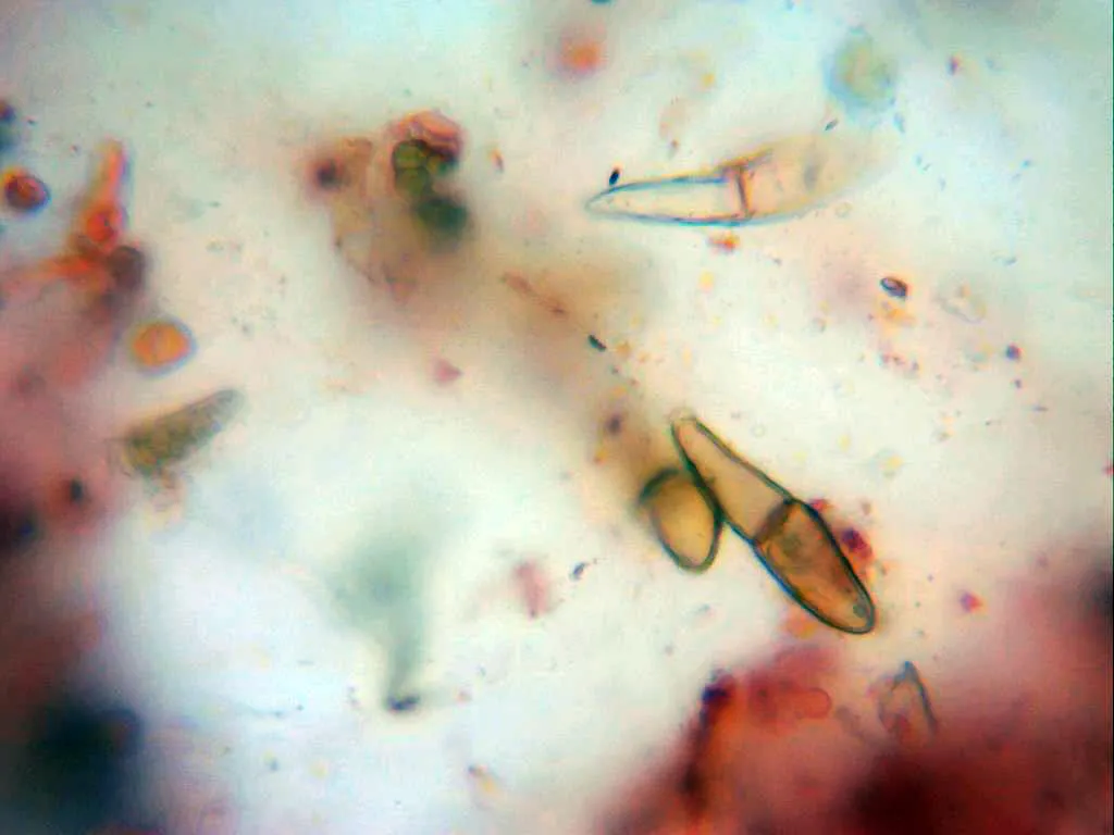 13 - Teliospora x 400